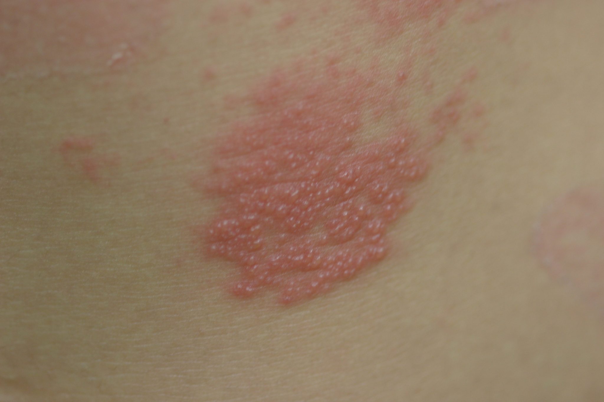 医師に連絡する時期